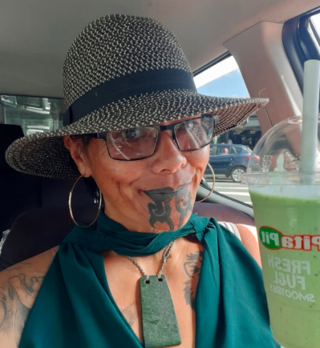 After-sleeve-surgery