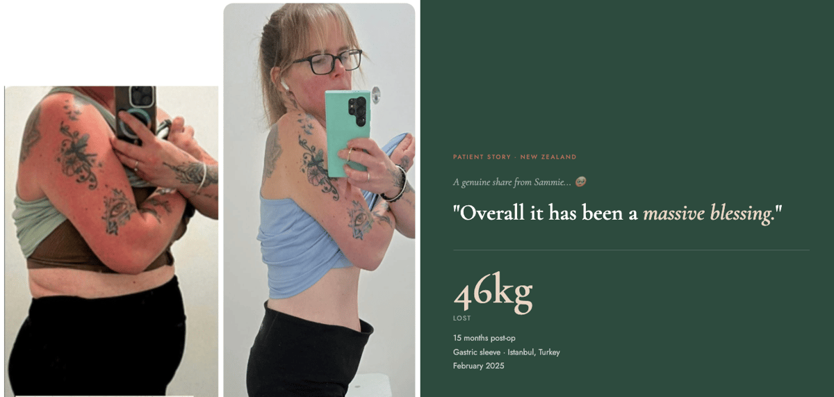 Don't Wait — Sammie Lost 46kg After Gastric Sleeve Surgery in Istanbul and Hasn't Looked Back