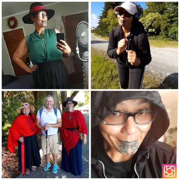 Karo -sleeve surgery