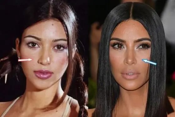 Kim-kardashian-nose-job-