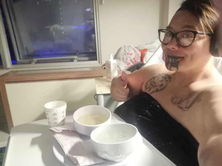 Sleeve surgery 2 days after