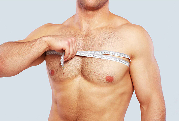 after-gynecomastia