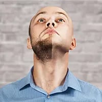 Beard Transplant