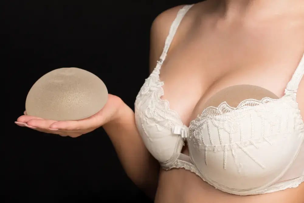 breast-implant-results