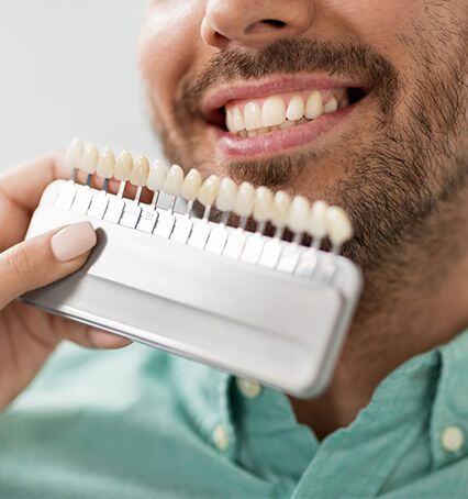 dental-veneers