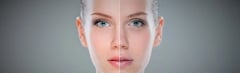 What Causes Dull Skin?