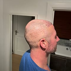 Emphair Amsterdam team were amazing