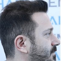 I am very happy with the change in my hair