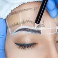 Brow Lift
