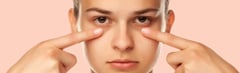 What are Dark Circles Under Your Eyes?