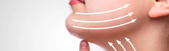 What is Double Chin Surgery?