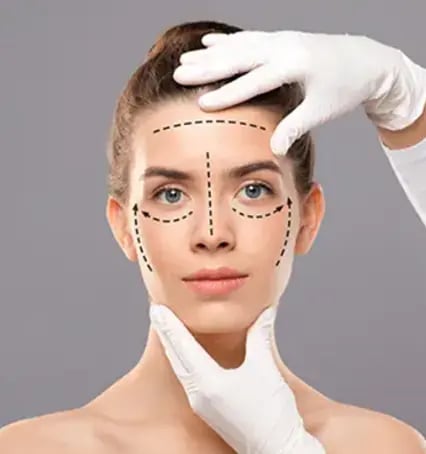 facelift-treatment