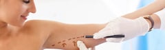 What Causes Stubborn Arm Fat?