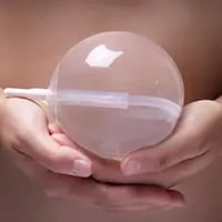 Gastric Balloon