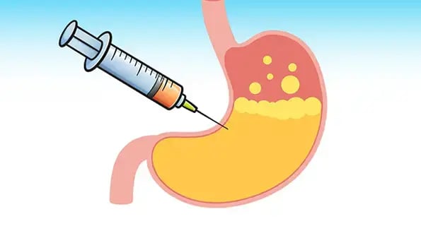 gastric-injections