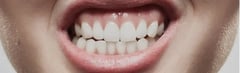 What Causes a Gummy Smile?