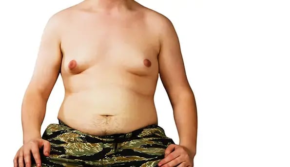 gynecomastia-for-men