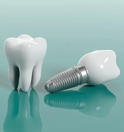 A dental implant with its crown next to a natural tooth