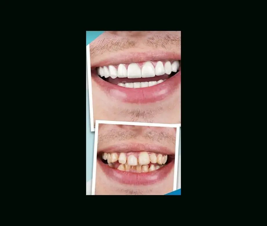 istadental-before-after-12