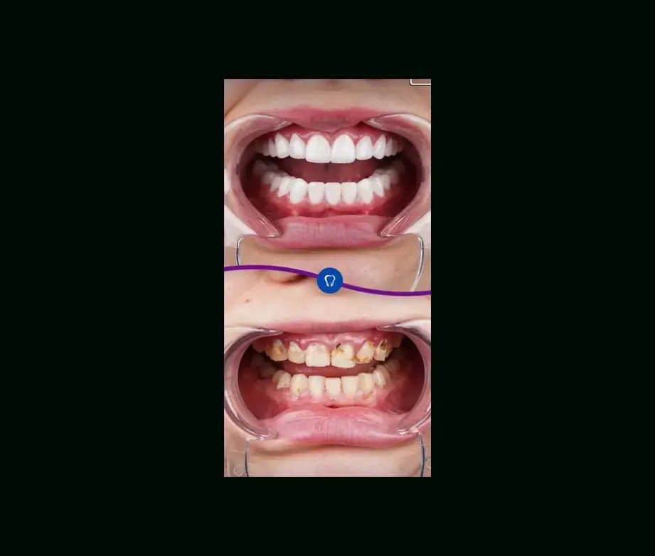 istadental-before-after-13