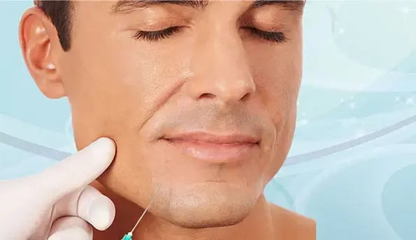 jawline-filler-for-men