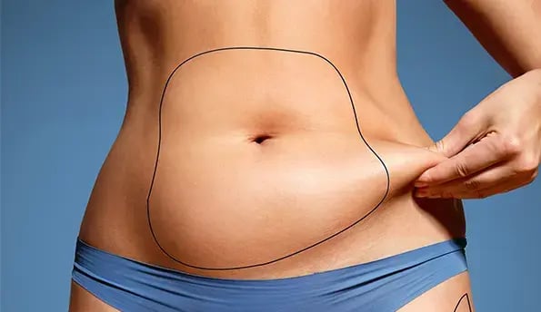 liposuction-cost