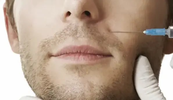 male-dermal-filler