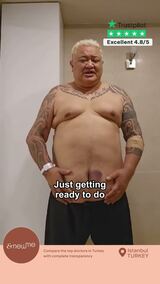 Steward's gastric sleeve