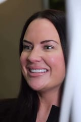 20 e.max veneers