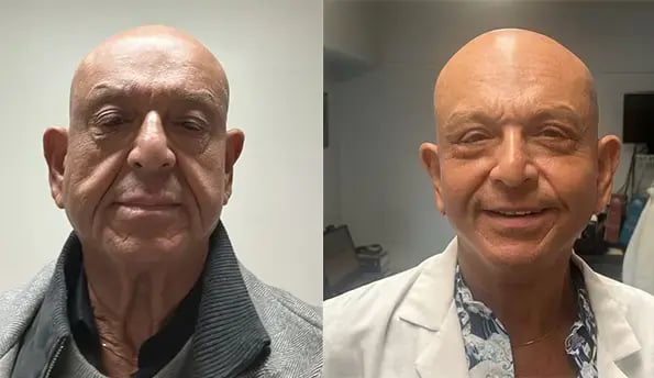 I had a fantastic experience with my surgery abroad