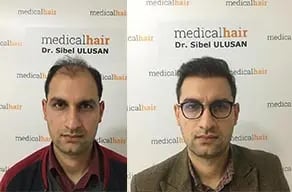 medicalhair-before-after