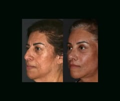 A Life-Changing Experience with Dr. Mehmet Cömert and &NewMe