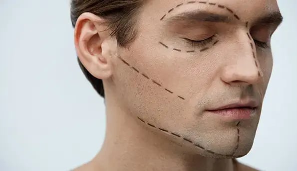 mens-facelift-surgery