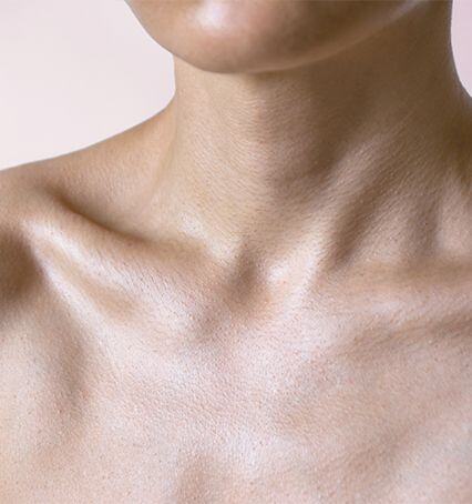 neck-lift