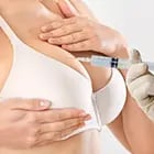Non Surgical Breast Lift