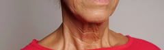 Causes of Neck Wrinkles: Factors Behind Aging Skin