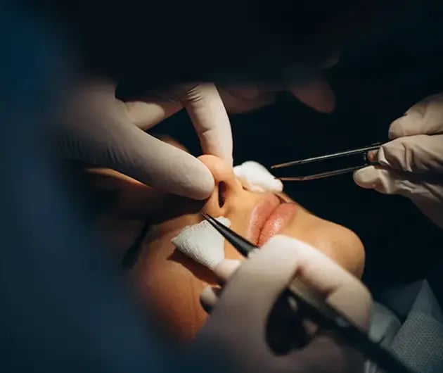prepare-for-rhinoplasty