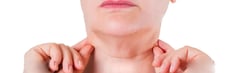 How to Get Rid of a Fat Neck