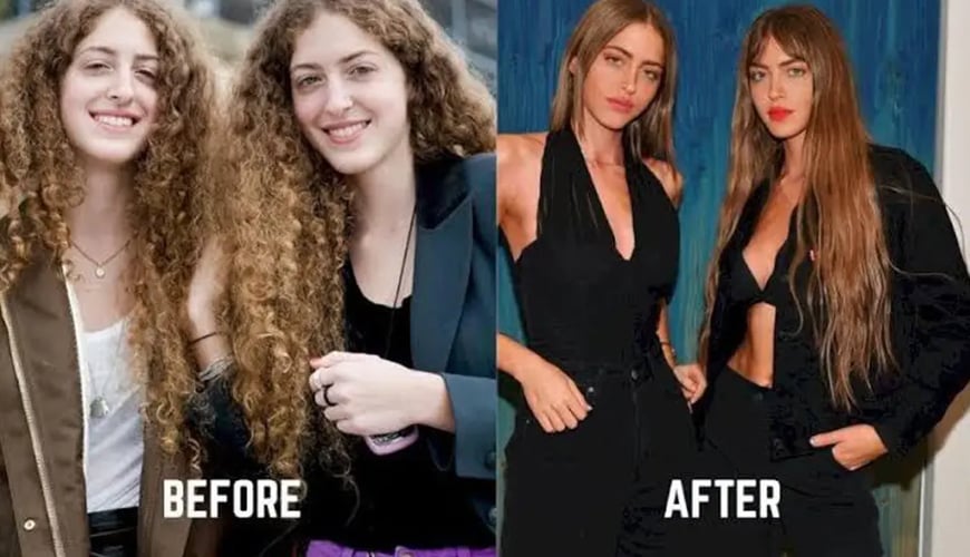 Simi Haze Age