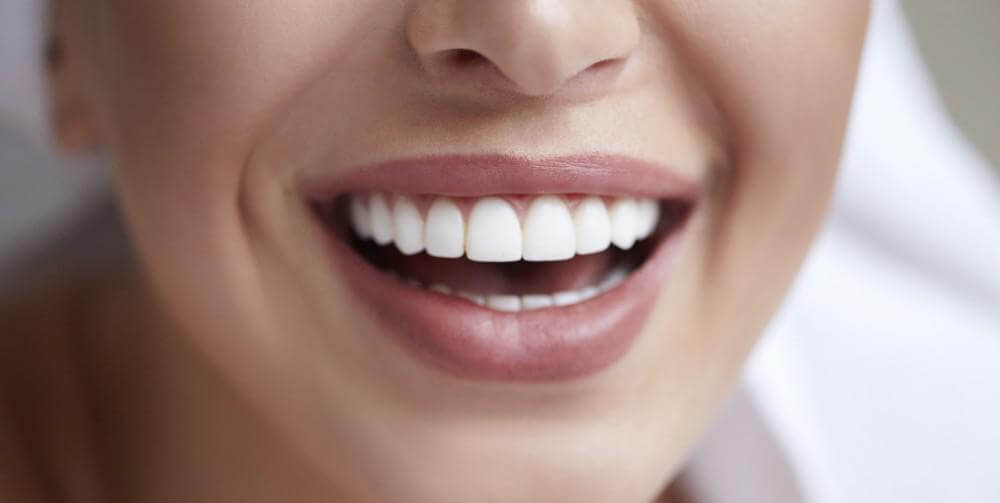 Close-up of a natural-looking smile