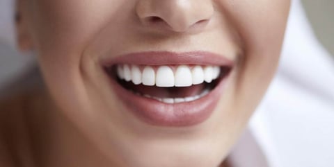 Dental Crown