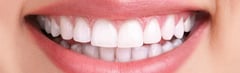 What is Tooth Discoloration?