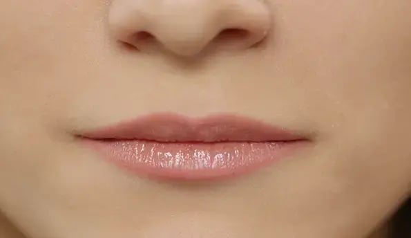 thin-lips