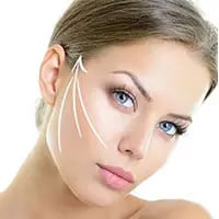 Thread Lift