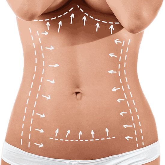 tummy-tuck (1)_11zon