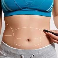 Vaser Liposuction