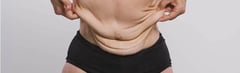 Ways to Lose Weight