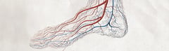 What are Spider Veins?