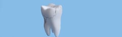 What is a Fractured Tooth?