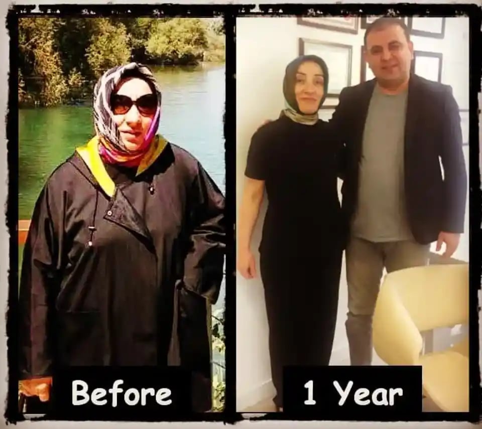 yener-demirtas-md-lipedema